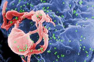Paciente é pesquisado por desenvolver anticorpos contra o HIV