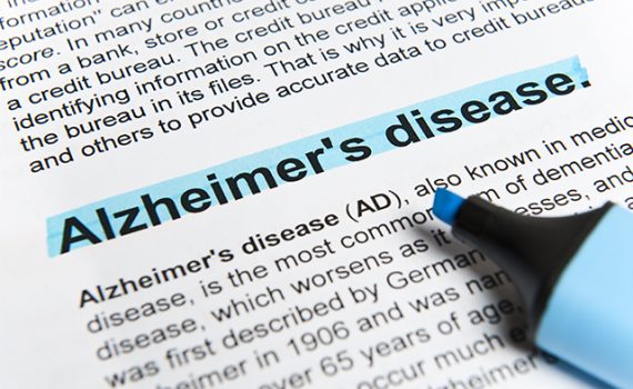 Pesquisadores conseguem replicar a fase silenciosa do Alzheimer