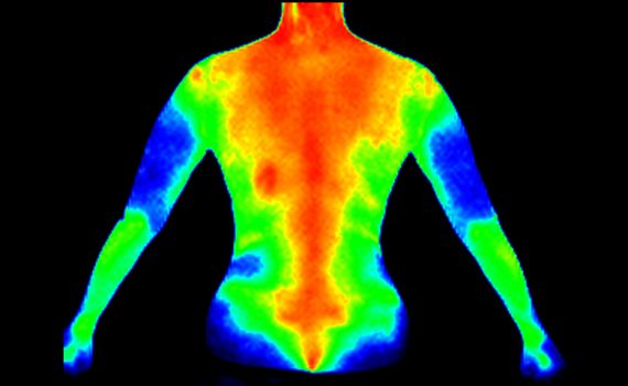 Tecnologia que calcula temperatura do corpo ajuda a prevenir lesões