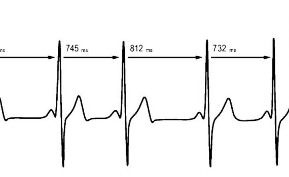 Medición de la variabilidad de la frecuencia cardíaca (VFC) podría ser útil para entrenamientos físicos
