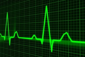 Papel del preparador físico en la rehabilitación cardíaca