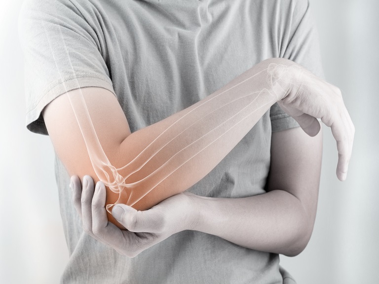 funiber-osteoporosis-evitar Ejercicio moderado en la juventud podría prevenir la osteoporosis según estudio