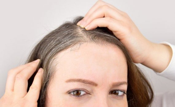 El estrés puede hacer que el pelo se vuelva gris, y puede ser reversible