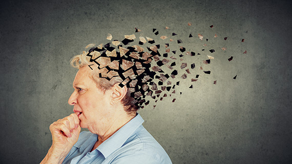 El vínculo entre el TDAH en adultos y el riesgo de demencia